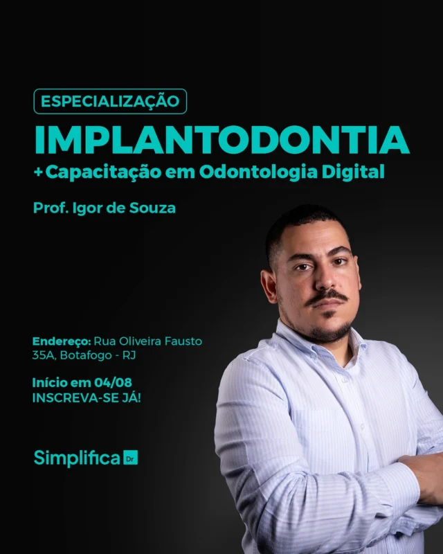 Facetas de Resina Estratificadas